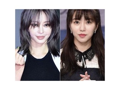 권민아 피부과 시술 중 화상 입어 안타까움